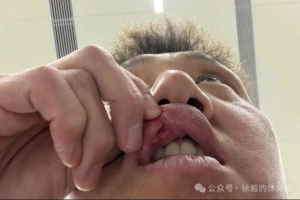 高迪赛后共缝九针:昨天蛮疼今天又是一条好汉,不想错过踢申花